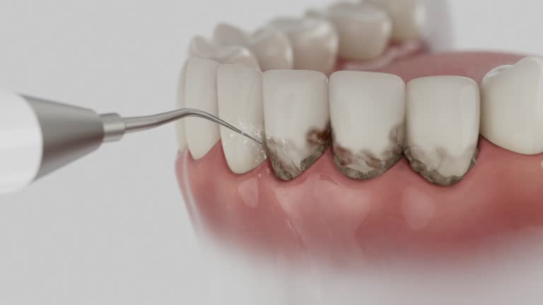 Trusted Root Canal Treatment service in Utqiagvik, AK - Dentist Open Now